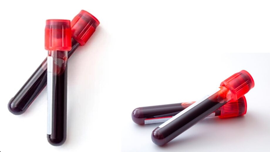 Phlebotomy Intravenous Infusion.
