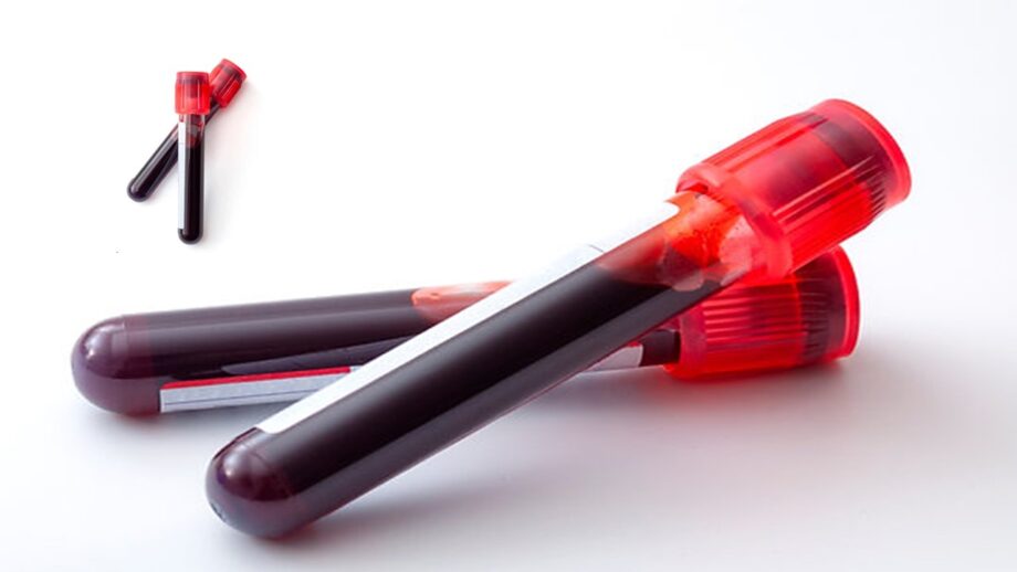 Phlebotomy at OneTouch